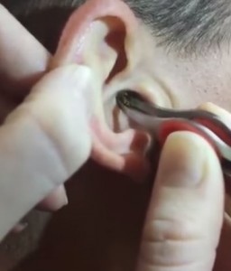 ear