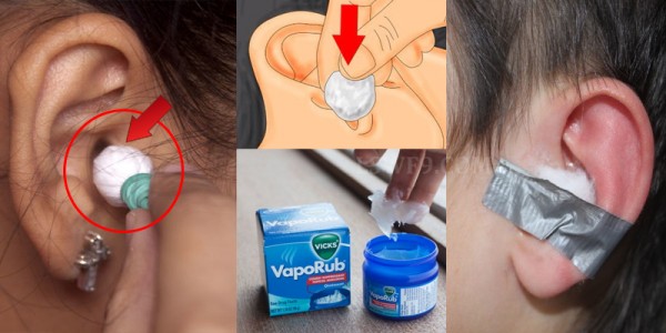 She-Puts-Vicks-VAporub-On-A-Cotton-Ball-And-Sticks-It-In-Her-Ear
